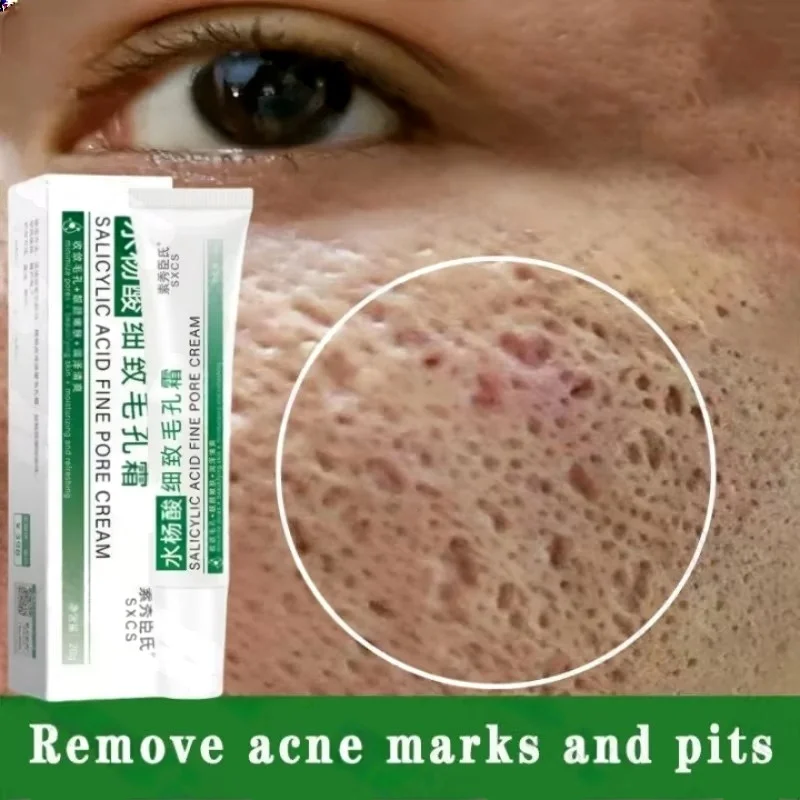 Salicylic Acid Blackhead Remover - Krem z kwasem salicylowym do oczyszczania