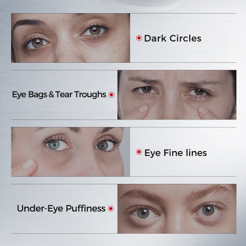 Płatki pod oczy na cienie pod  – Collagen Under Eye Patches recenzja i cena