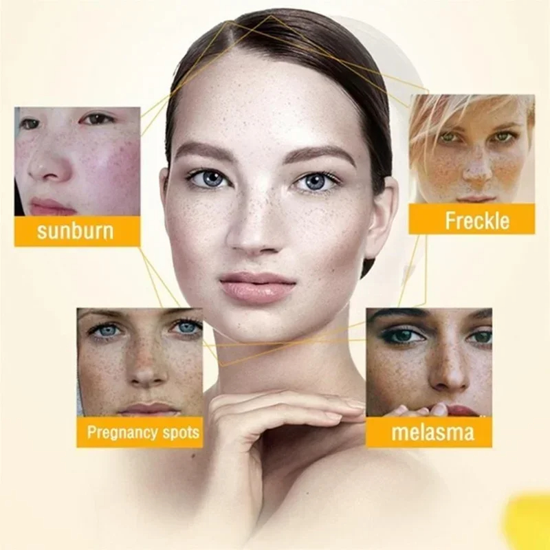Usuń krem zmarszczek Retinol t – Retinol Anti Wrinkle Cream recenzja i cena