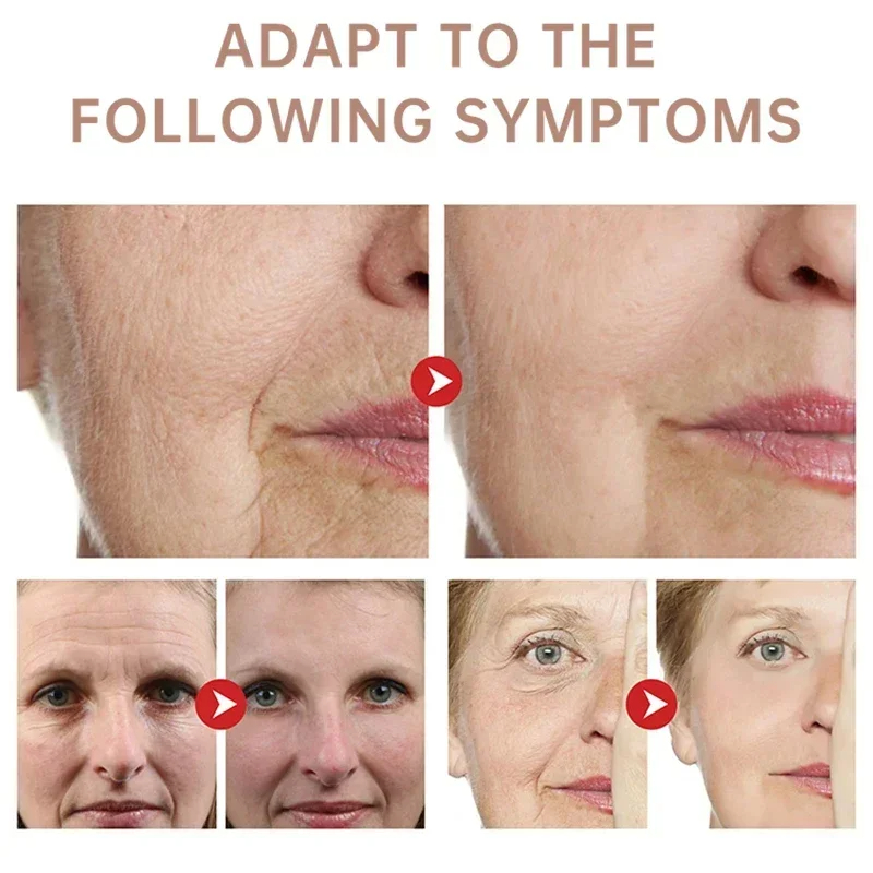 Usuń krem zmarszczek Retinol t – Retinol Anti Wrinkle Cream recenzja i cena
