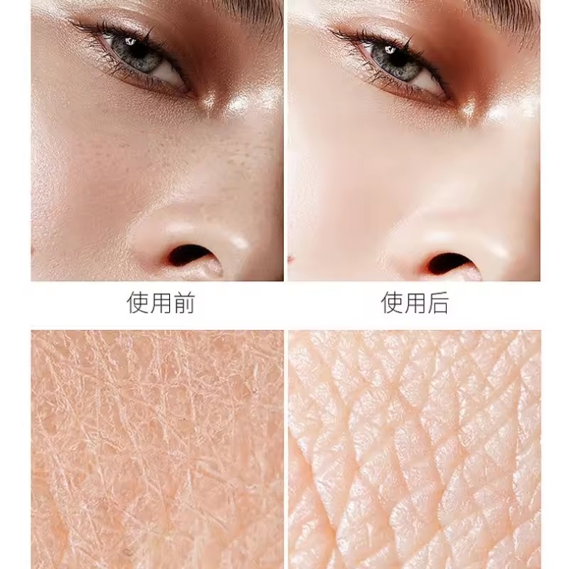 Kwas hialuronowy esencja niacy – Niacinamide Pore Shrinking Essence recenzja i cena