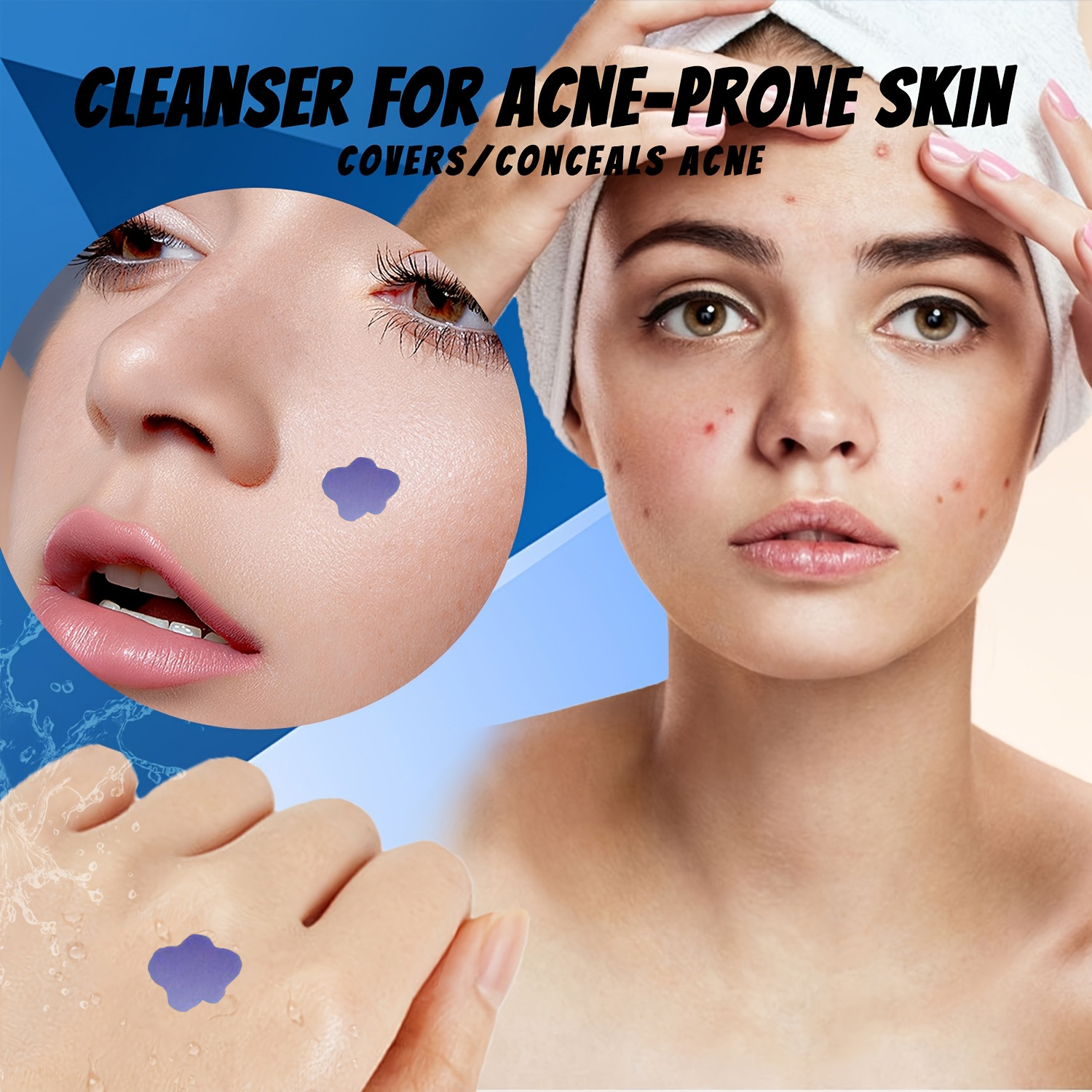 Plasterki z mikroigłami na trą – Skincare recenzja i cena