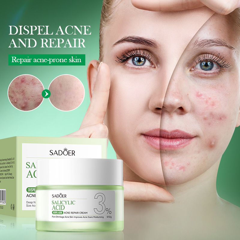 Krem na trądzik z kwasem salic – Salicylic Acid Blackhead Remover recenzja i cena