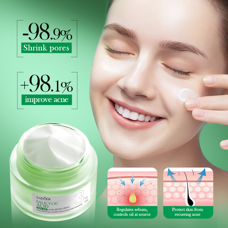 Krem na trądzik z kwasem salic – Salicylic Acid Blackhead Remover recenzja i cena
