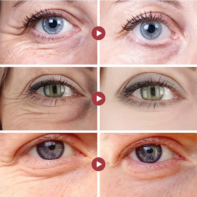 Plastry na zmarszczki pod ocza – Collagen Under Eye Patches recenzja i cena