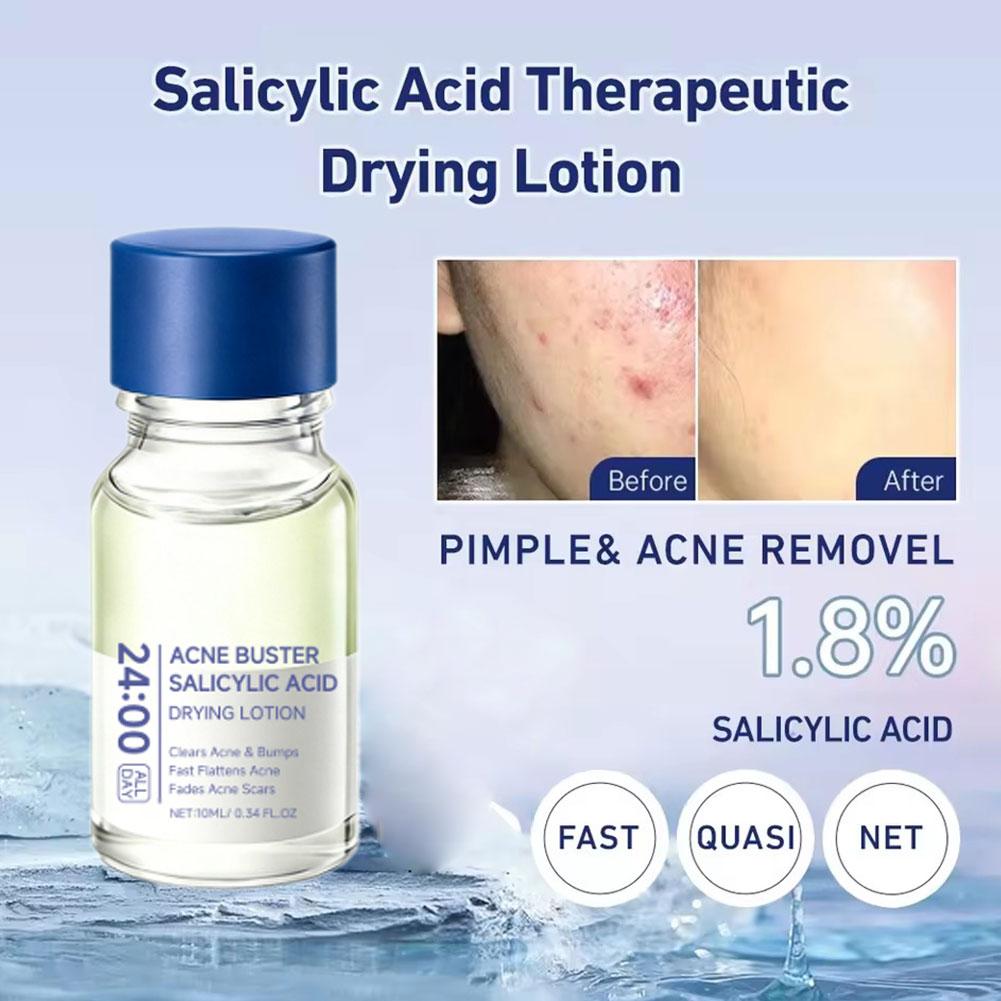 Kwas salicylowy – preparat na  – Salicylic Acid Blackhead Remover recenzja i cena